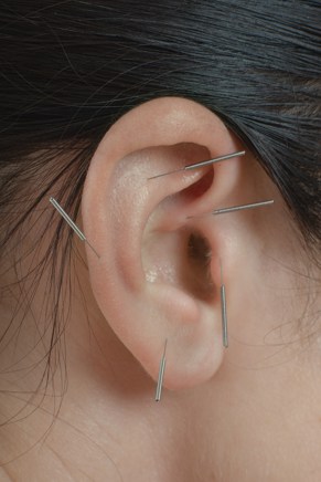 Billede af nåle i øret